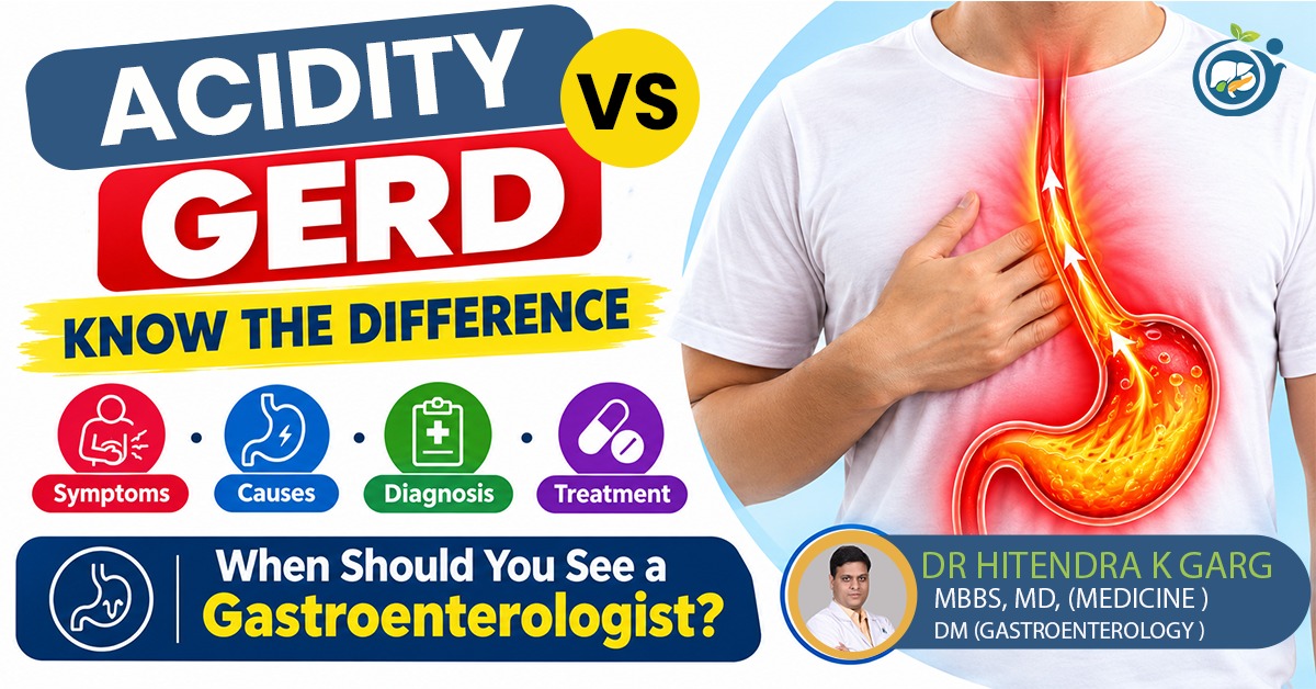 Acidity vs GERD: Symptoms, Causes, Treatment & Key Differences