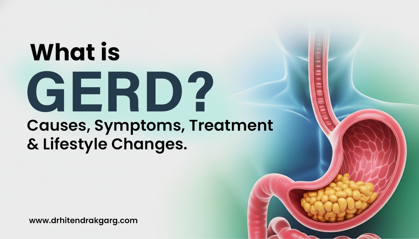 What Is GERD? Causes, Symptoms, Treatment & Lifestyle Changes